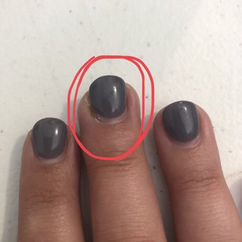 Longwood Nails And Spa - Infected middle finger - Nail Salons Near Me - Longwood, Florida Longwood Nails And Spa - Infected middle finger - Nail Salons Near Me - Longwood, Florida
