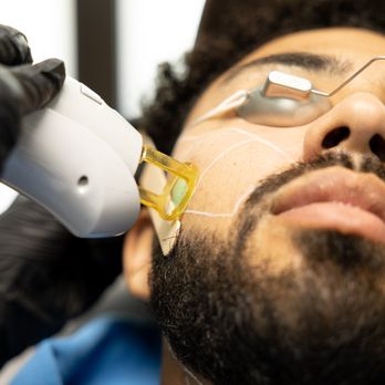 Skin - A man's line up is only $49 per session. - Skin Care Near Me - Las Vegas, Nevada Skin - A man's line up is only $49 per session. - Skin Care Near Me - Las Vegas, Nevada