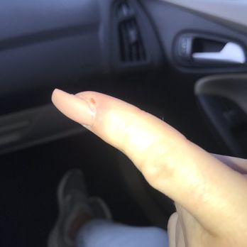 Bella Nails - Where he cut my finger. I understand things happen, but he didn't apologize or seem to care. - Nail Salons Near Me - Redding, California Bella Nails - Where he cut my finger. I understand things happen, but he didn't apologize or seem to care. - Nail Salons Near Me - Redding, California
