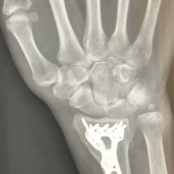 Steve Meadows, MD - My Right digits