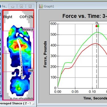 Prevail Physical Therapy - Pressure mapping and custom foot orthotics - Physical Therapy Near Me - Shoreline, Washington