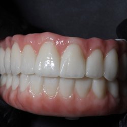 Dentaluxe - Same day dental implants
