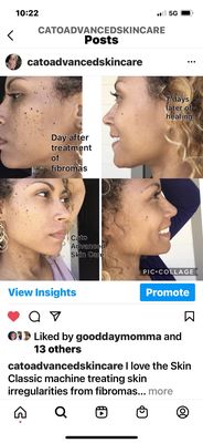 Cato Advanced Skin Care