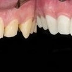 Oley Valley Family Dentistry