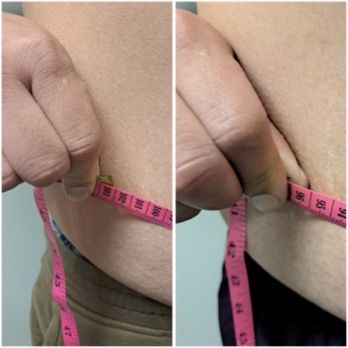 Ink Me Aesthetics - Body Contouring Near Me - Sacramento, California