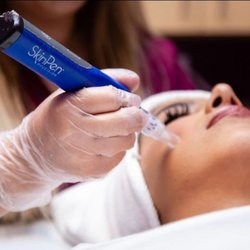 Laser Perfection - We offer Micro needling with Skinpen