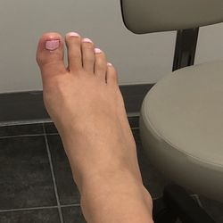 Spiri Anthony S DPM - Homegirls toe has a heartbeat of its own at this point.