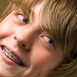 Laurent Orthodontics - Dental work
