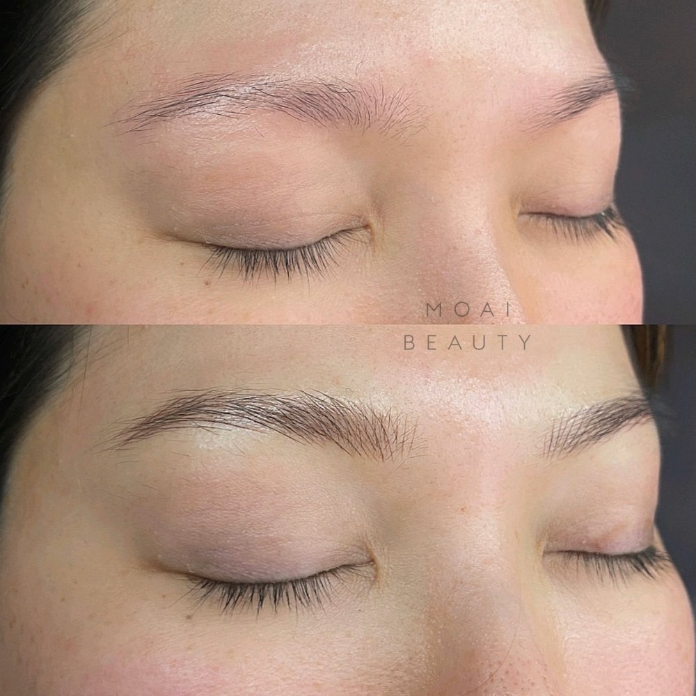 Reviv Med Spa & Laser Treatment The Ultimate Guide To Reviv Med Spa & Laser Treatment - Medical Spa In