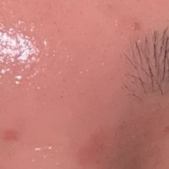 Fresh Look Threading - ^ Burn from waxing done at this business. - Waxing Near Me - Rancho Cucamonga, California