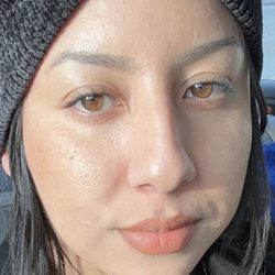 Km Esthetics - Brighter, healthier skin!! only wearing lipstick and contour in photo! no foundation. no concealer! The results are dramatic!