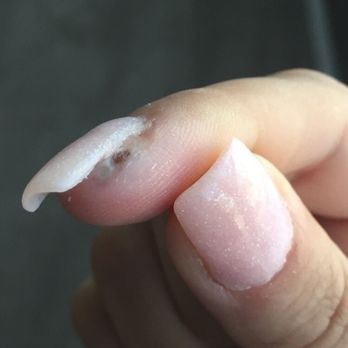 The Nail Bar - Infected finger after being cut while getting nails done by Khem. - Nail Salons Near Me - Maitland, Florida The Nail Bar - Infected finger after being cut while getting nails done by Khem. - Nail Salons Near Me - Maitland, Florida