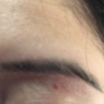 Renu Beauty - Hair Removal Near Me - New Rochelle, New York Renu Beauty - Hair Removal Near Me - New Rochelle, New York