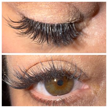 Cloud 9 Med Spa Naples - Estheticians Near Me - Naples, Florida Cloud 9 Med Spa Naples - Estheticians Near Me - Naples, Florida