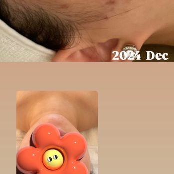 Genesys Laser Clinic - Laser Hair Removal Near Me - New York, New York Genesys Laser Clinic - Laser Hair Removal Near Me - New York, New York
