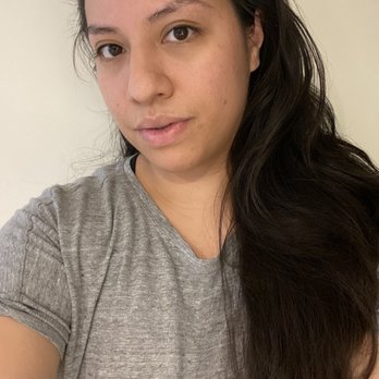 SKINBySabrina - After - Skin Care Near Me - Redondo Beach, California