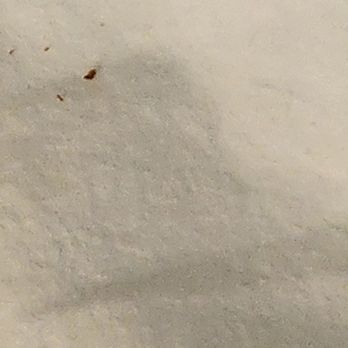 Marriott's Harbour Lake - Blood from bed bug bites - Hotels Near Me - Orlando, Florida