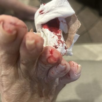 Pink Petals Nails Spa - Cuts on top of toe - Nail Salons Near Me - Scottsdale, Arizona