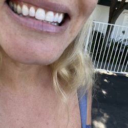 Christine Highum, DDS - Teeth cleaning