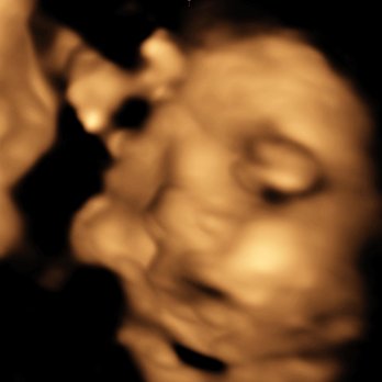 Heavenly 3D 4D Ultrasounds - Our baby girl - Diagnostic Imaging Near Me - Upland, California Heavenly 3D 4D Ultrasounds - Our baby girl - Diagnostic Imaging Near Me - Upland, California