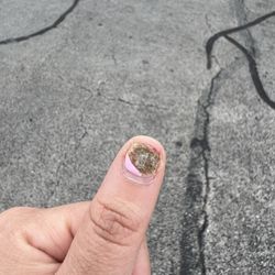 G Nails - Fungal infection