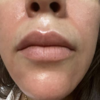 Le Jolie Medi Spa - Areas of treatment aren't as thorough as other providers. - Medical Spas Near Me - West Hollywood, California Le Jolie Medi Spa - Areas of treatment aren't as thorough as other providers. - Medical Spas Near Me - West Hollywood, California