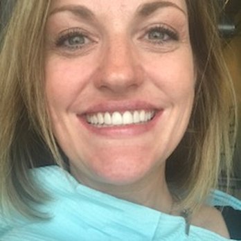 East Austin Dental - New Veneers! LOVE! - General Dentistry Near Me - Austin, Texas
