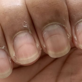Royal Nails Spa - Deep indentations in the nails after going to this salon! - Nail Salons Near Me - Charlottesville, Virginia Royal Nails Spa - Deep indentations in the nails after going to this salon! - Nail Salons Near Me - Charlottesville, Virginia