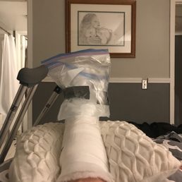 My poor broken foot .. OUCH! My poor broken foot .. OUCH!