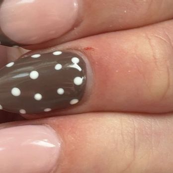 Blooming Nails - Caldwell - Filed nails caused cuticle damage and bleeding - Nail Salons Near Me - Caldwell, New Jersey