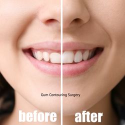 De G Nguyen, DDS
