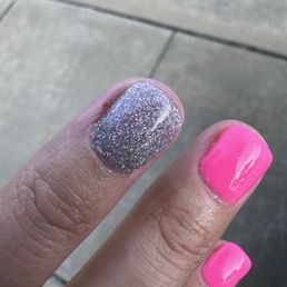 Cut skin with the nail drill. This is the ring finger, the cut is on the side Cut skin with the nail drill. This is the ring finger, the cut is on the side