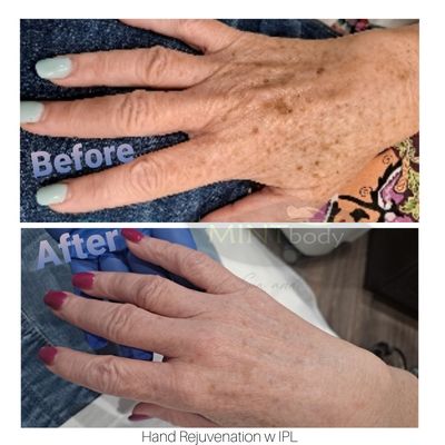 Mintbody Medical Spa & Wellness