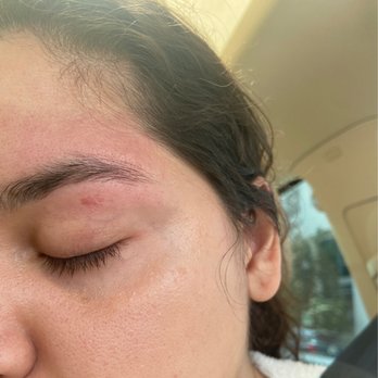 Face Brow and Beauty Bar - Skin missing from my eyelid after the wax - Skin Care Near Me - Miami, Florida Face Brow and Beauty Bar - Skin missing from my eyelid after the wax - Skin Care Near Me - Miami, Florida