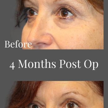 Avron Lipschitz, MD - Athena Plastic Surgery - Cosmetic Surgeons Near Me - Stuart, Florida