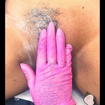 D.beauty - Before and during Brazilian wax - Waxing Near Me - Fremont, California D.beauty - Before and during Brazilian wax - Waxing Near Me - Fremont, California