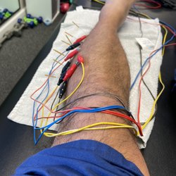 Busybody Fitness & Rehab - Dry needling to release the muscle tension