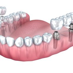 Avie Oral Surgery Group