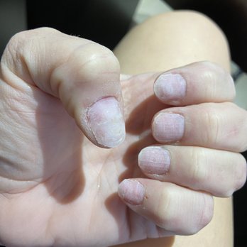 Spa & Nails by Amy - This is a before picture. - Skin Care Near Me - Atascadero, California Spa & Nails by Amy - This is a before picture. - Skin Care Near Me - Atascadero, California