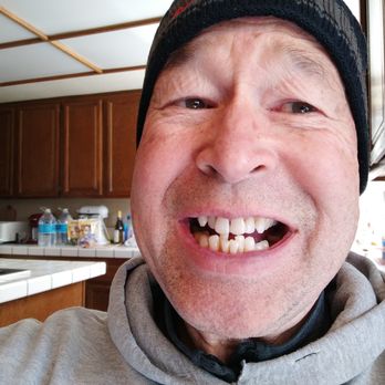 Dr. Gray Orthodontic Specialists - My teeth in 2021 before seeing Dr. Gray. - Orthodontists Near Me - Upland, California Dr. Gray Orthodontic Specialists - My teeth in 2021 before seeing Dr. Gray. - Orthodontists Near Me - Upland, California