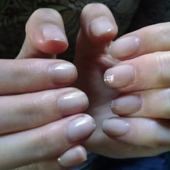 Queen Nails Bar & Spa - My nails the day after my manicure - read my review for all the details of how this employee butchered my nails. - Nail Salons Near Me - Fort Wayne, Indiana