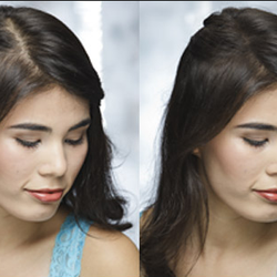 Pizarro Hair Restoration