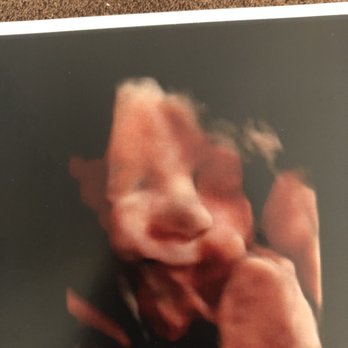 The Baby Connection - Diagnostic Imaging Near Me - Sacramento, California The Baby Connection - Diagnostic Imaging Near Me - Sacramento, California