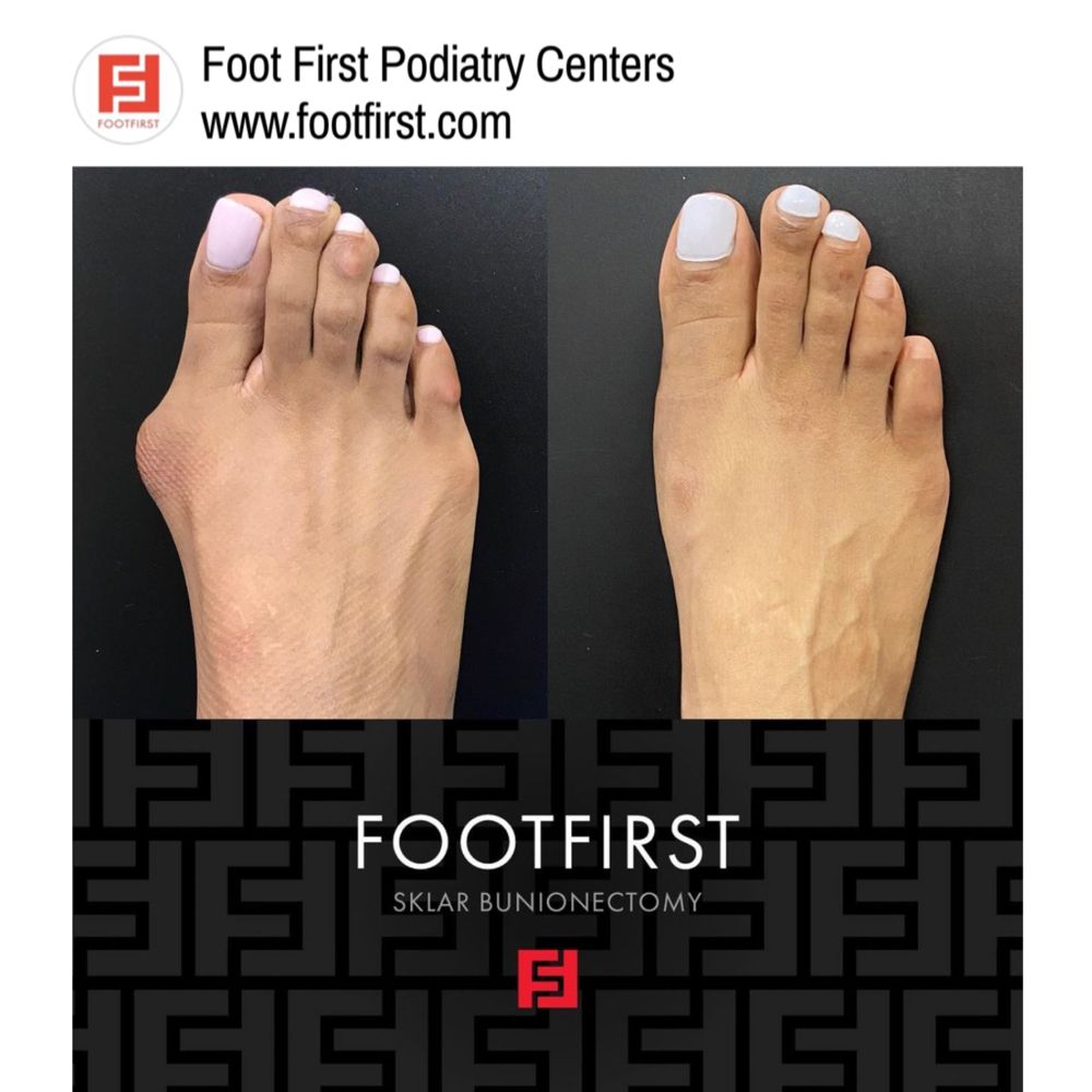 FOOT FIRST PODIATRY CENTERS Updated October 2024 108 Photos 2425