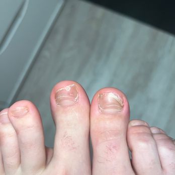 Divas Nails Spa - toenails were infected during pedicure and fell off - Nail Salons Near Me - Highland, California
