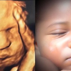Chubby Cheeks 3D/4D Ultrasound Studio of High Point & Greensboro