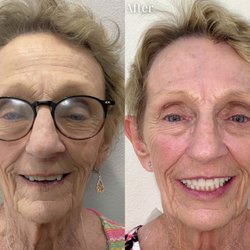Dentist Henderson - All Smiles By Design