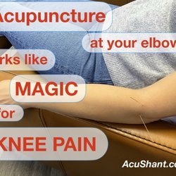 Shant Baboujian Acupuncture - How can acupuncture at your elbow fix your knee pain? You gotta feel it to believe it!  Make your appointment