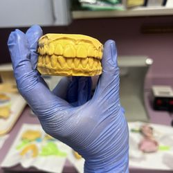 National School of Dental Assisting - Stone model for practice