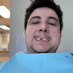 Teeth